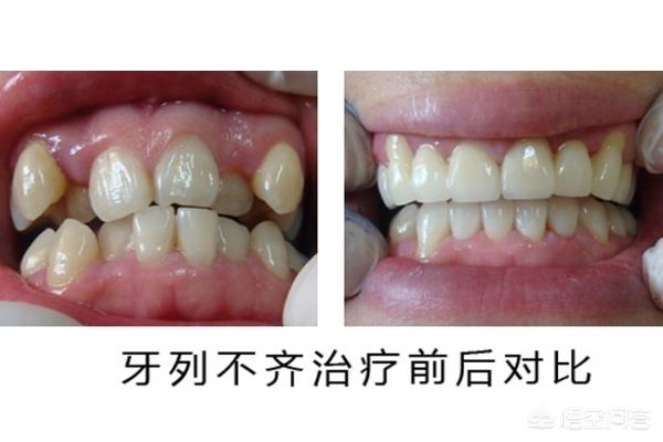 苍南最新24小时牙医在线咨询方法分析(最方便真实的苍南有没有24小时牙医方法)