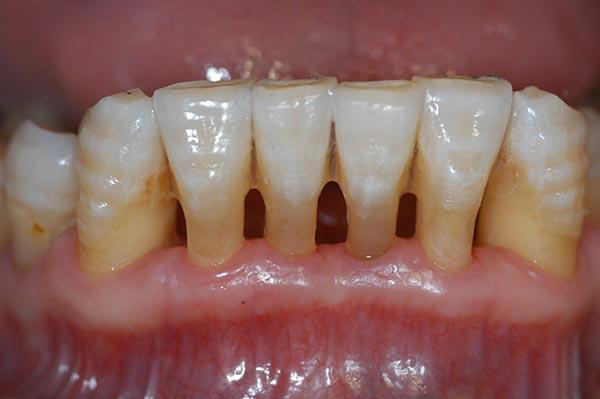 苍南最新24小时牙医在线咨询方法分析(最方便真实的苍南有没有24小时牙医方法)